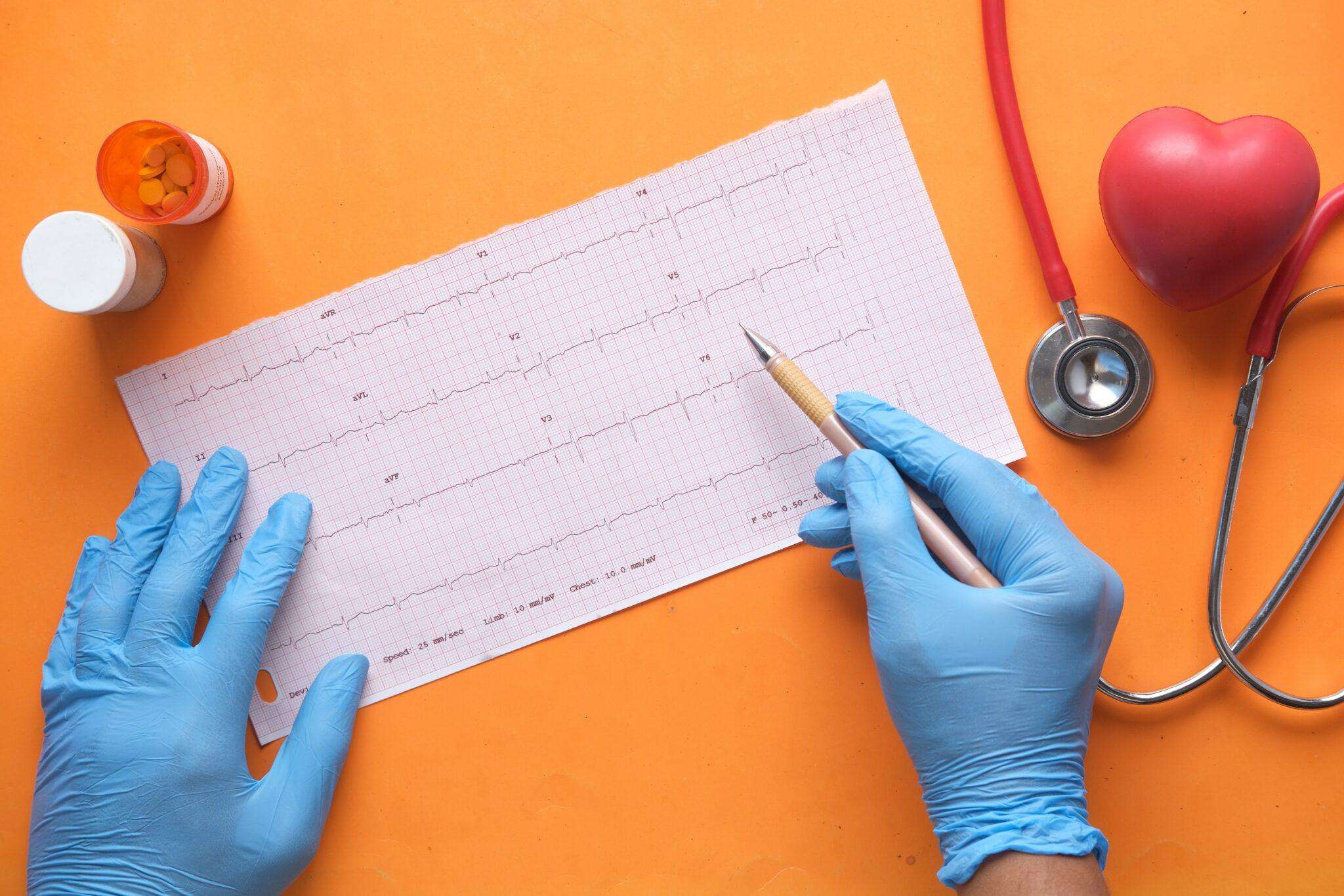 heartbeat monitor results with a person holding a pencil wearing blue medical gloves
